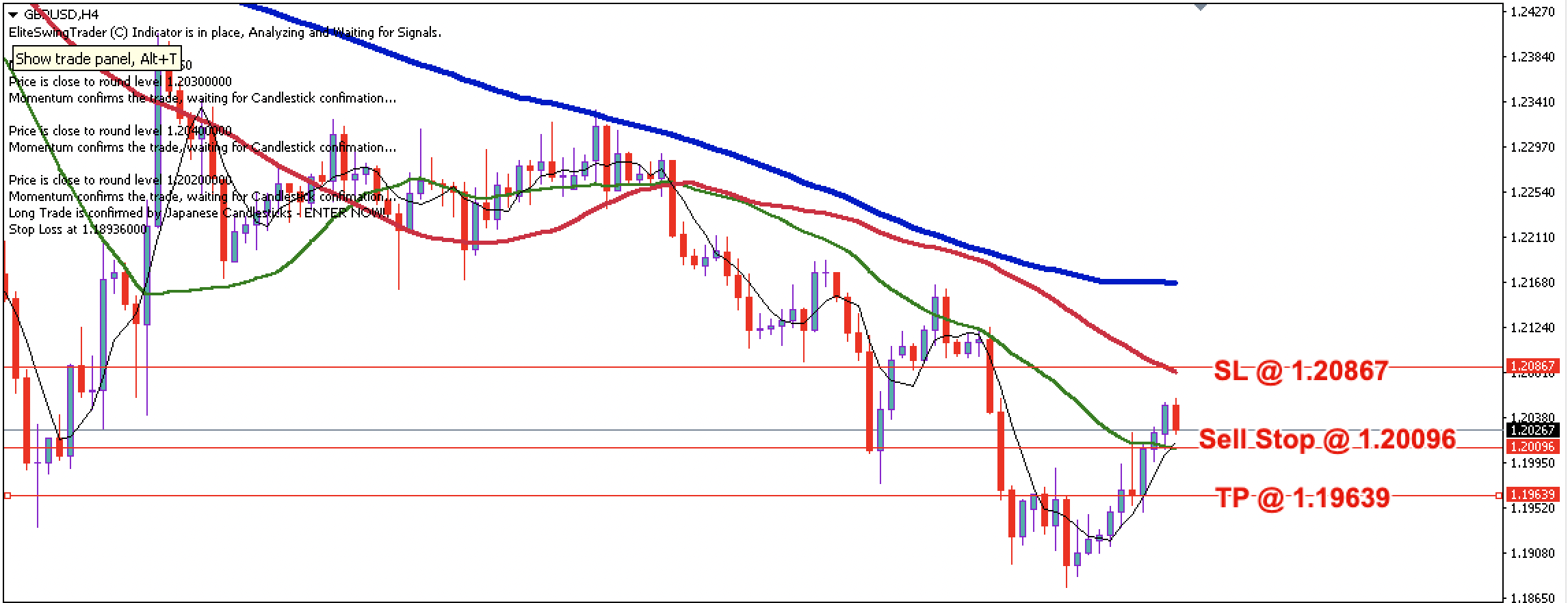 GBP/USD Daily Price Forecast – 8th July 2022