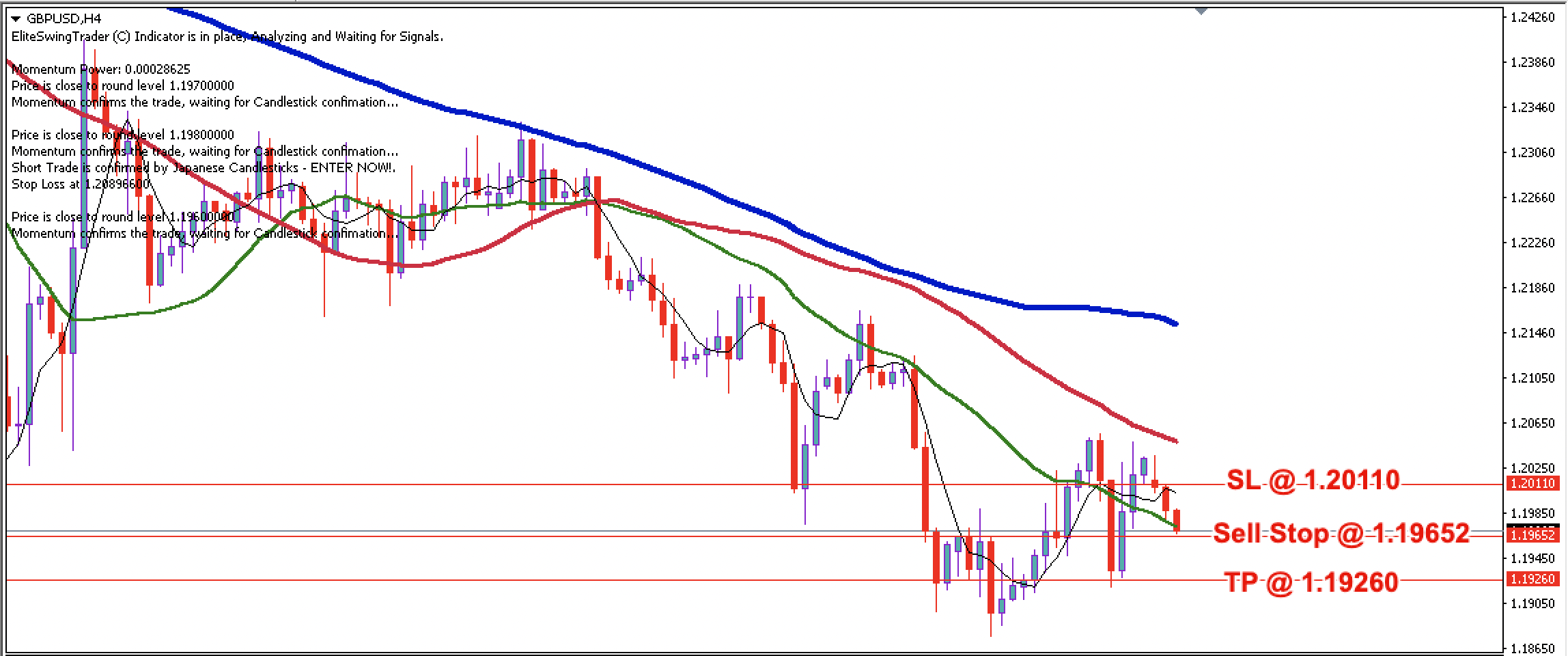 GBP/USD Daily Price Forecast – 11th July 2022